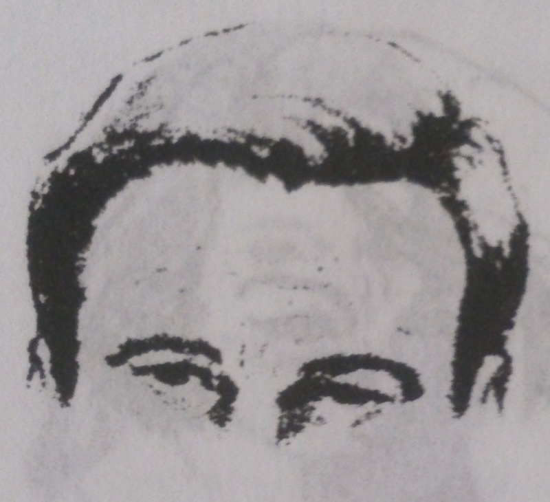 горизонтальные морщины на лбу