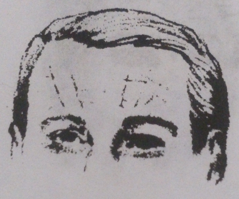 вертикальные морщины на лбу