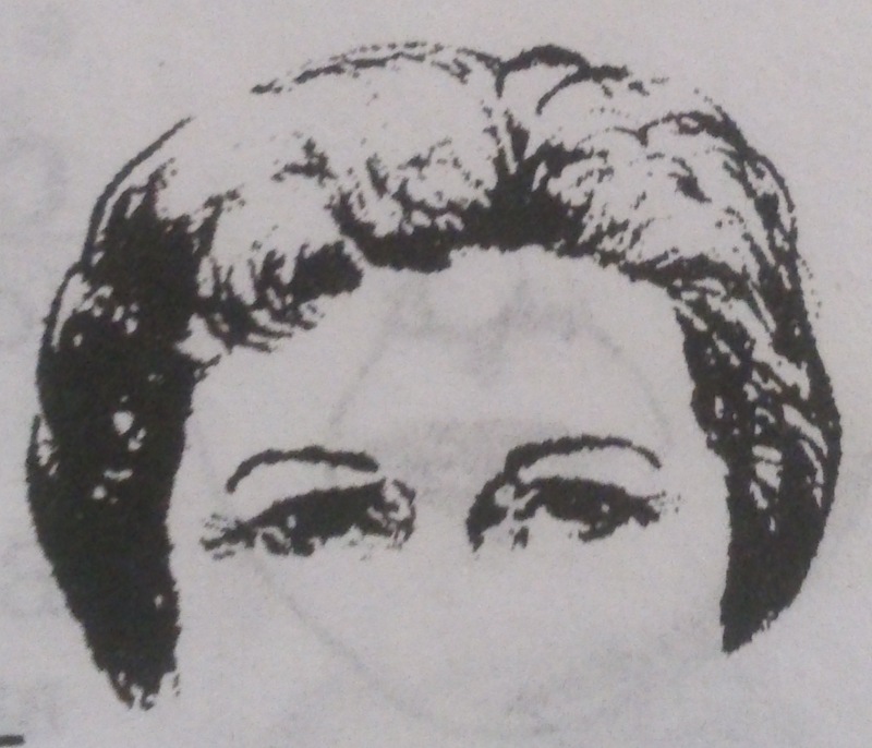 морщинки от краев глаз