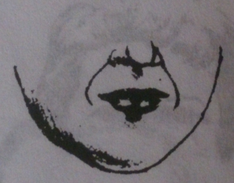 складка к уголкам рта