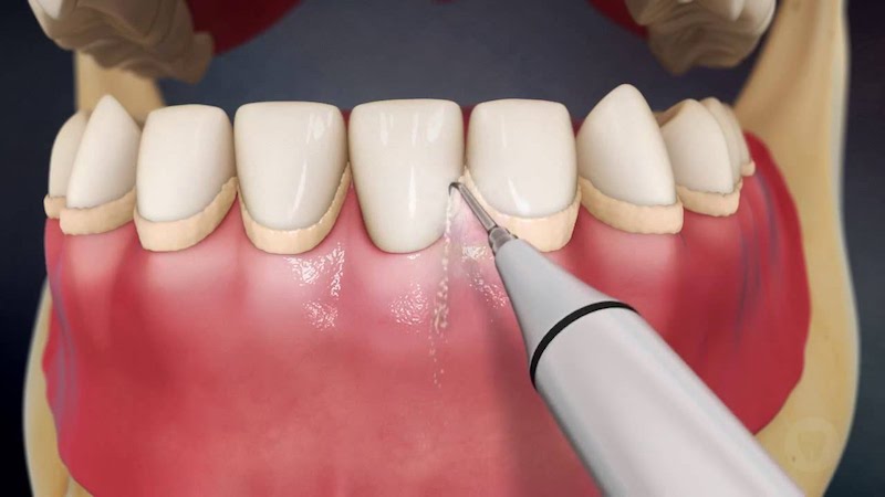 teeth